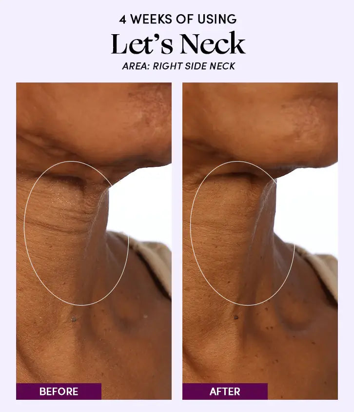 Let's Neck - Neck Serum w/ Cooling Applicator