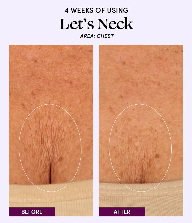 Let's Neck - Neck Serum w/ Cooling Applicator