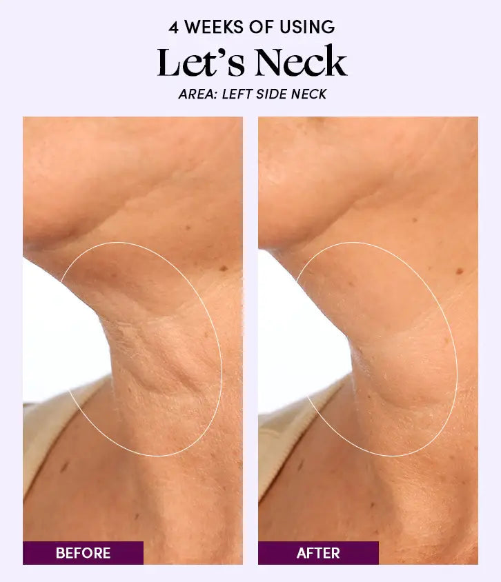 Let's Neck - Neck Serum w/ Cooling Applicator