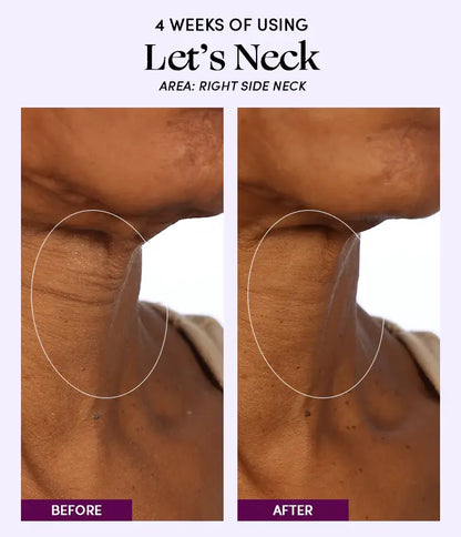 Let's Neck - Neck Serum w/ Cooling Applicator