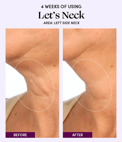 Let's Neck - Neck Serum w/ Cooling Applicator